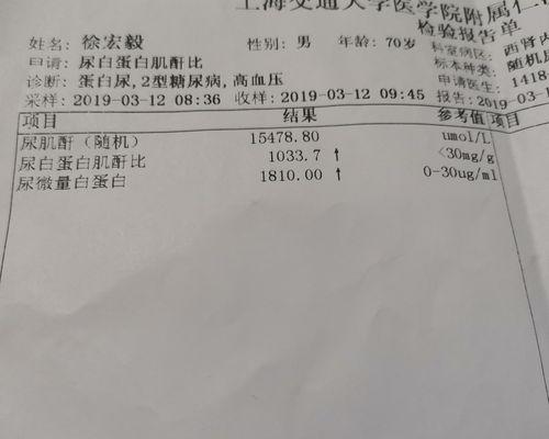 狗狗的肌酐和尿素指标解读（以宠物为主）