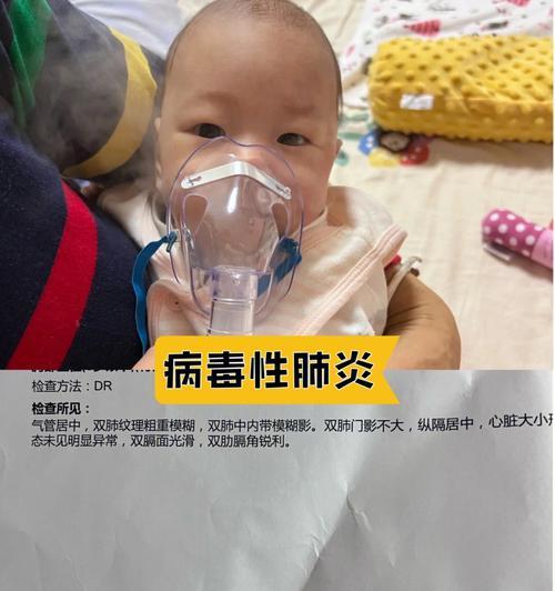 小狗的呼吸之声（探索小狗气管喉咙的奥秘）