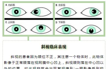 吉娃娃斜视有哪些原因？有什么好的治疗方法吗？