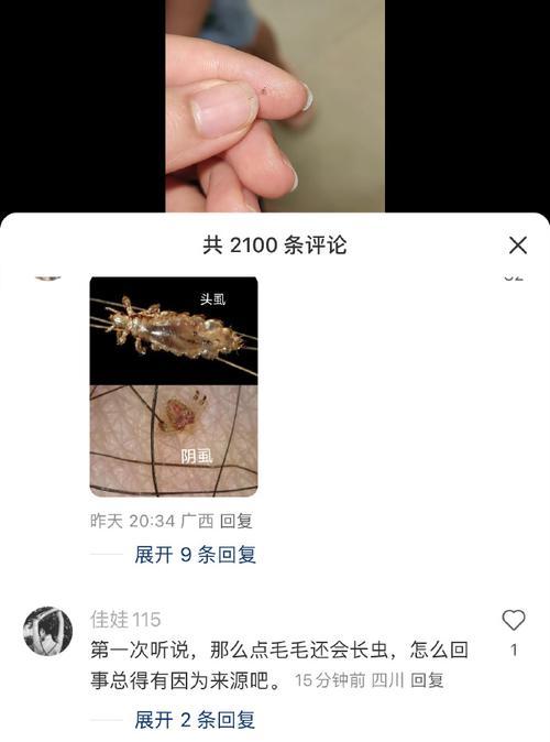 阴虱感染是否与宠物有关？怎么处理？